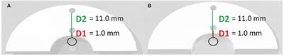 Temperature analysis of 3D-printed biomaterials during unipolar and bipolar radiofrequency ablation procedure